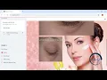 IEEE Final Year Project Skin Disease Prediction Machine Learning streamlit Web App - Python