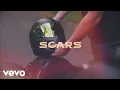 Download Lagu Scotty Hasting - Scars (Visualizer)