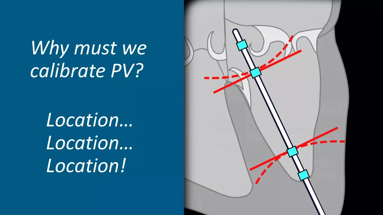 Webinar – Understanding Ventricular Pressure Volume Catheter Calibrations and Experimental Design