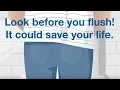 Look Before You Flush Bladder Cancer Awareness Cxbladder