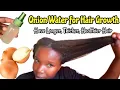 ONION JUICE NO SMELL Stop Hair Loss Grow Longer Hair TREAT BALDNESS ALOPECIA THIN EDGES