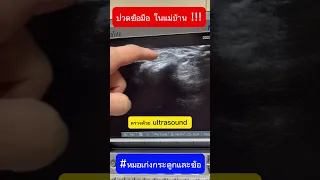  ทำไมข้อมือข้างขวาถึงบวมและเจ็บมากเมื่อเคลื่อนไหว 