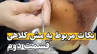 نکات مش کلاهی   آکادمی شهرزاد دندنها