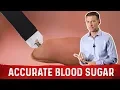 The Most Accurate Method To Test Blood Sugar is NOT A1C Test - Dr Berg