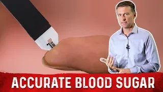 The Most Accurate Method To Test Blood Sugar is NOT A1C Test - Dr Berg