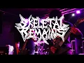 Skeletal Remains discusses Obituary, preserving old-school death metal sound and Devouring Mortality