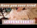 Acupuncture and Cupping in Okinawa Japan SO AMAZING Deployment Vlog Shae Taylor