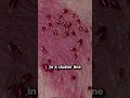 Download Lagu Signs of Bedbugs | #shorts
