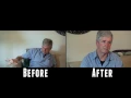 Download Lagu Medical Marijuana and Parkinson's Part 3 of 3