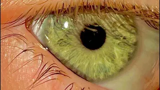 اقوى سبليمنال عيون خضراء النتائج النهائية خلال يومين 