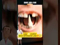 Download Lagu Ternyata gigi copot bisa dipasang lagi⁉️😱🦷 #viralvideo #funfacts #trending #shorts #fyp #viral