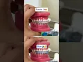 color that make your teeth look WHITER