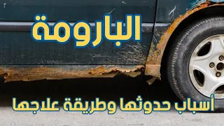 البارومة وأسباب حدوثها وطريقة علاجها دندنها
