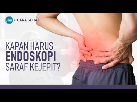 Endoskopi, Prosedur Alternatif Untuk Saraf Kejepit Tanpa Operasi