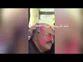 حقيقة الشريحة التي تم وضعها لعلي عبدالله صالح شاهد لايفوتك