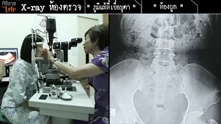 อาการคันตาที่เกิดจากฝุ่นหรือการทำความสะอาดบ้าน โดยไม่มีตาแดงหรือขี้ตา แต่มีเมือกตอนเช้าและตุ่มเล็ก ๆ บนตาขาว คือโรคอะไร