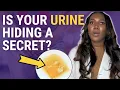 Is Your Urine Silently Screaming Symptoms of Kidney Disease 5 Alarming Signs