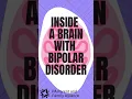 Download Lagu Inside a Brain with Bipolar Disorder