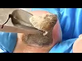 Download Lagu Black toenails eroded by fungus, trimmed clean【Xiao Yan Pedicure】#asmr