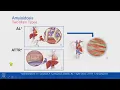 Treatment Update Medications for Cardiac Amyloidosis
