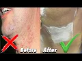 Download Lagu No More Skin Irritation? Try This Routine!