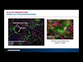 Download Lagu AnaBios Webinar | Single Cell Sequencing to Identify Distinct Cell Populations from Fibrotic Tissue