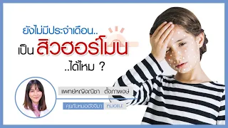  ทำไมเด็กหญิงวัยรุ่นถึงมีสิวขึ้น และเกิดจากอะไรบ้าง 