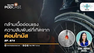 การรักษาโรคกล้ามเนื้ออ่อนแรงมีวิธีใดบ้าง