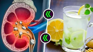 কিডনি Stone এর লক্ষণ, কারণ ও ঘরোয়া যত্ন | Kidney Health Tips Bangla