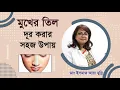 Lagu মুখের অতিরিক্ত ছোট ছোট কালো তিল দূর করার উপায় | Mole Treatment