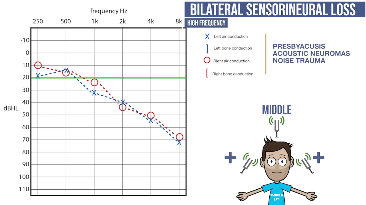 Audiograms