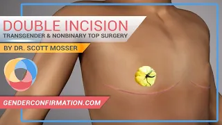 transgender u0026 non binary double incision top surgery by dr scott mosser