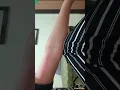 Yang hobi kerokan mana?