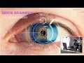 Iris Scanner Explained