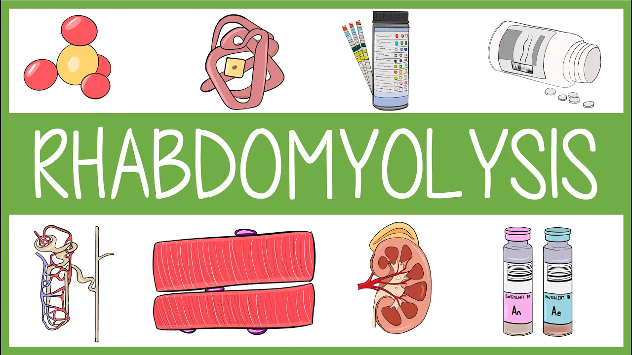 Rhabdomyolysis Visually Explained