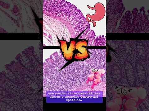 Estómago vs Colon #medical #medicina #histology #histologia #medicina #biology