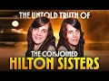 America s Most Famous Conjoined Twins Had A Dark Secret