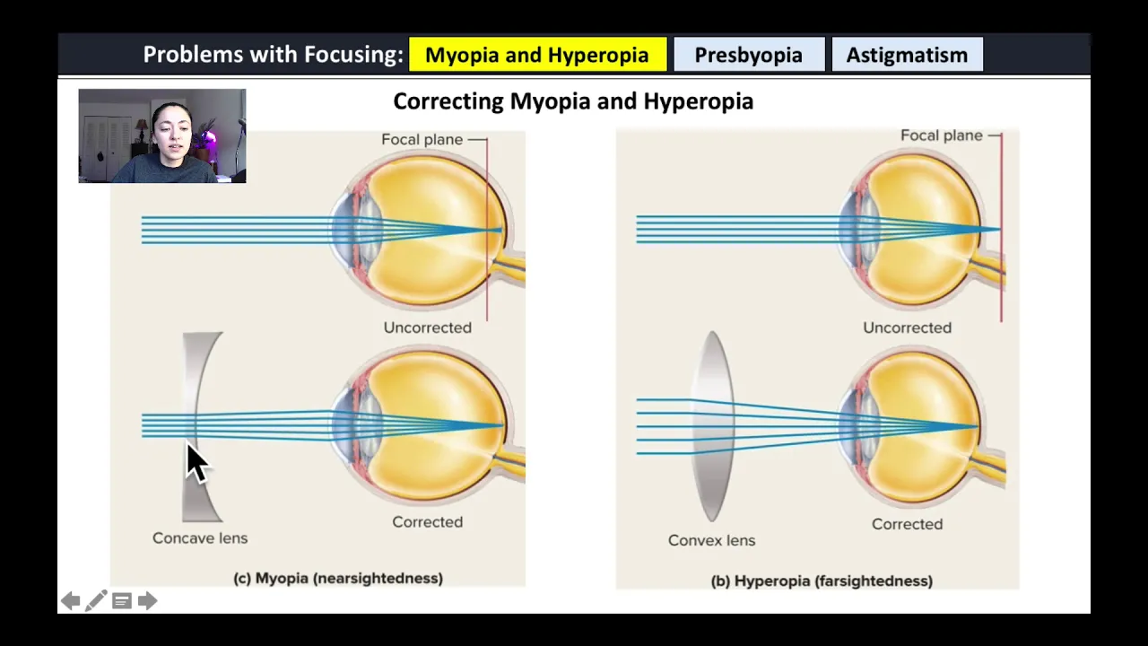 Physiology of the Eye Lecture
