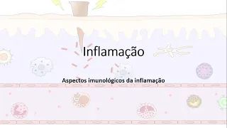 Inflamação, Resposta inflamatória, Quimiocinas; Migração leucocitária; Fagocitose.