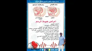 اعراض هبوط الرحم 