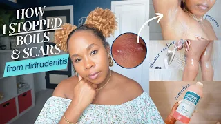 How I STOPPED HS Boils Scars in Armpits Thighs TMI Hygiene Shower Routine Diet MORE