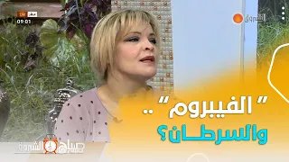 هل يمكن أن يتحو ل الفيبروم الى سرطان المختصة في طب النساء توض ح 