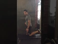 Obturator Nerve Glide