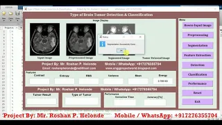 Matlab Project on Type of Brain Tumor Detection Using Image Processing Full Source Code