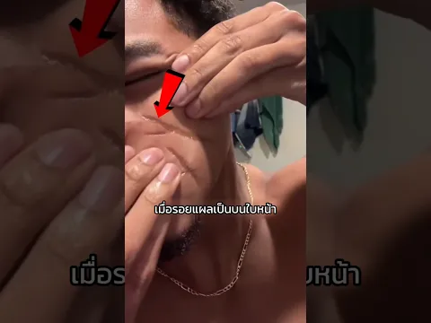 แผลเป็นปลอมที่เนียนที่สุดในโลก ทำยังไงถึงดึงผิวให้ยุบลงได้ขนาดนี้?