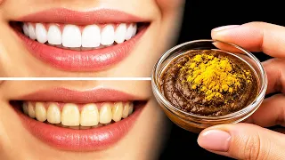 Dentists are silent about this! 🔥 Teeth whitening and tartar removal in 2 minutes!