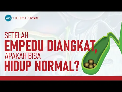 Kantong Empedu Diangkat, Apakah Tetap Bisa Hidup Normal?