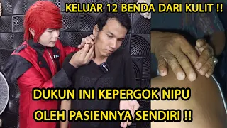 SANTET KELUAR 12 BENDA DARI KULIT ‼️ DUKUN TIKTOK KEPERGOK PASIENNYA SENDIRI - ILMU MERAH