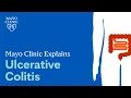 Mayo Clinic Explains Ulcerative Colitis