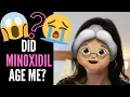 DOES MINOXIDIL ROGAINE CAUSE AGING My Story Doctors Thoughts On WRINKLES BAGS COLLAGEN LOSS